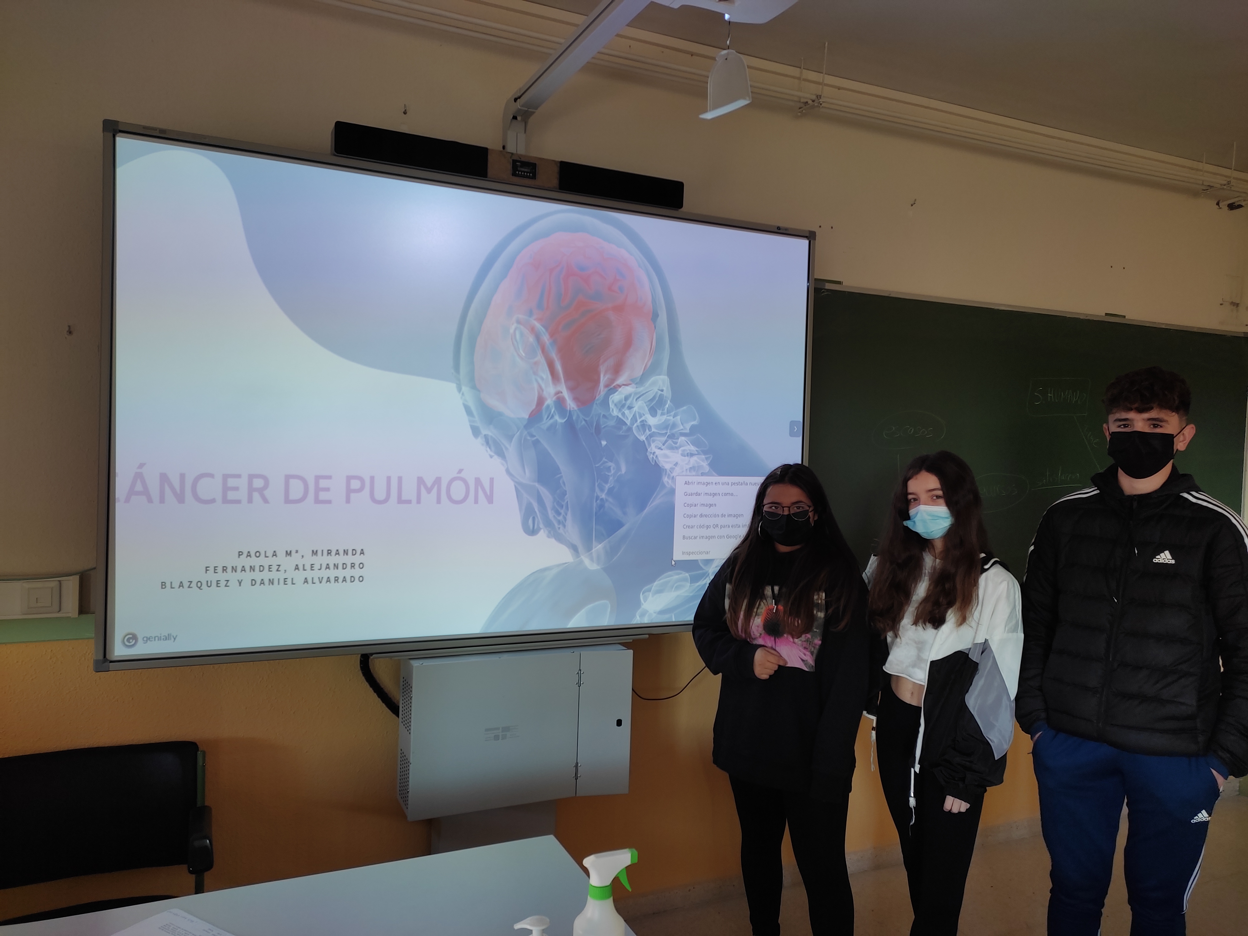 Grupo Cáncer de pulmón